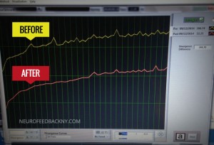 Neurofeedback NY before and after a session